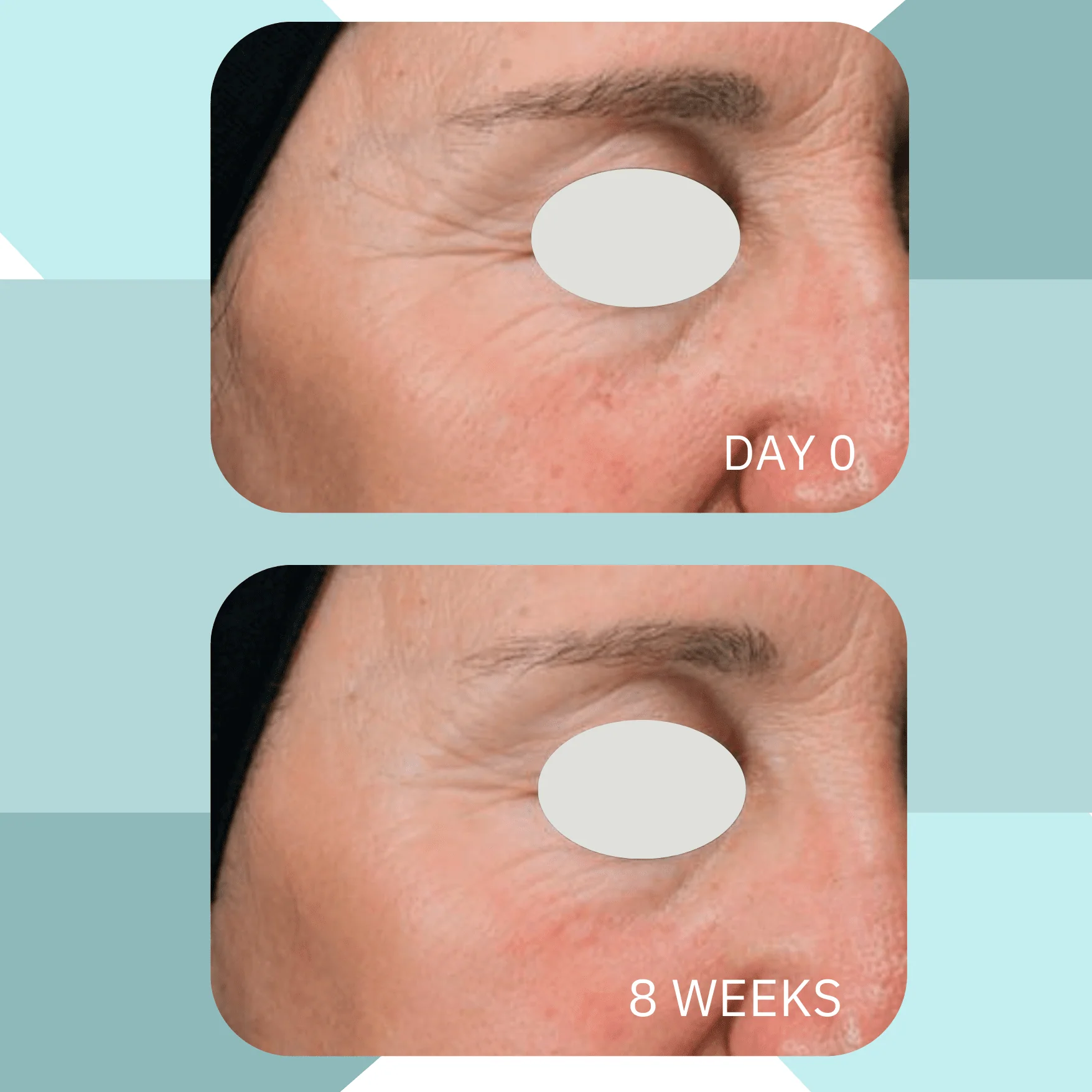 Ayurvedic Deep Hydrating Rejuvenation Crème - Image 4